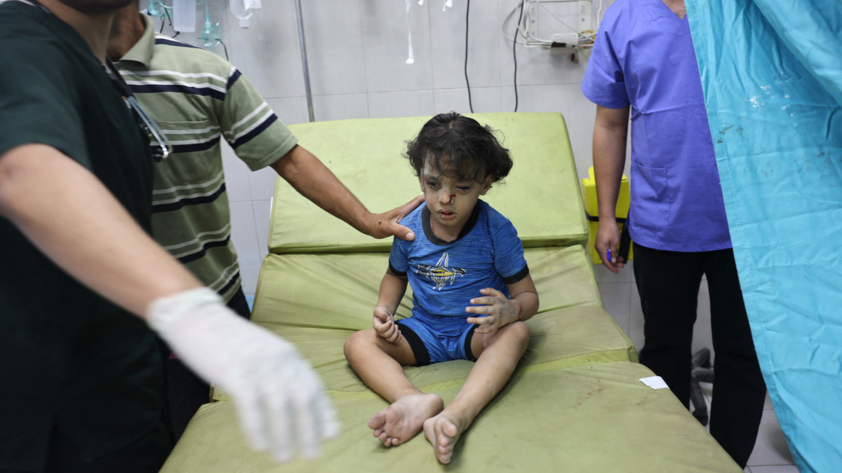 Een gewond kindje in Gaza. Beeld: ANP